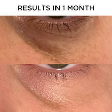 Load image into Gallery viewer, Hydrating Eye Serum