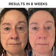 Load image into Gallery viewer, Brightening Vitamin C Serum